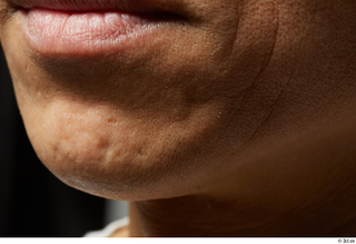  HD Face skin references Chikanari Ryosei lips mouth scar skin pores skin texture 0003.jpg